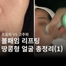 (주)엔엘소음진동기술 | 리프팅 종류 총정리 | 볼패임 땅콩형은 어떤 거 받을까 (고주파 초음파 차이)