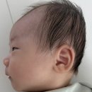 범안로 | [두상교정헬멧] 비바헬멧 한달차 두상변화 후기(할인코드, 단두교정)