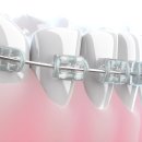 서울라미플란트치과교정과치과의원 이미지