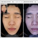 유앤아이의원 | 광고없는 유앤아이의원 후기 / 시술 200만원 하고 느낀점 가기전 필수