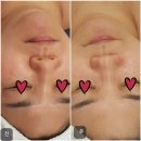 이성화헤어 | 🙋‍♀️수분폭탄 후기2(40대)