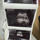 에스케이제이병원 | 수원 광교 산부인과 서브병원 정희정제이산부인과 후기 마미톡 ⭕️