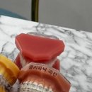 서울브라운치과의원에서 경험한 대전치아교정의 차이!