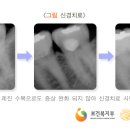 이라면 이미지