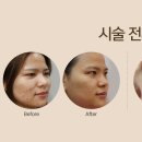 명품피부 이미지