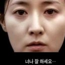 구형철