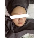 화명역 | [부산쥬베룩스킨] 화명역 피부과 추천 나비존 미간 후기