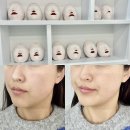 가오스 | 탕정역피부관리 가인미가 얼굴 비대칭 관리 후기