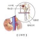 저나트륨혈증[hyponatremia] 이미지