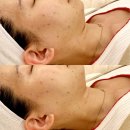 [ 부산 ] 부산웨딩관리 연산동왁싱 &#34; 클래시뷰티 &#34;