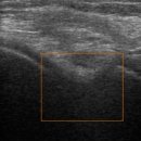 박철정형외과의원 이미지