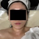 코앤덕농장 | stage 3. [포항] 윤곽관리로 얼굴 비대칭 교정하고 직각어깨 된 채니뽀, 설렘 스킨앤바디