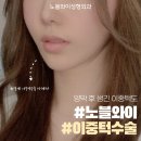 커스텀성형외과의원 네이버블로그