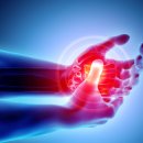 티엔에프(TNF) 이미지