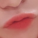 [입술필러/입꼬리필러] &lt;더웨이성형외과&gt; 내돈내산 후기 꾸준 업데이트 예정