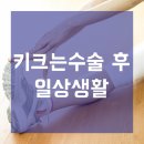 키크는수술 후 일상생활이 가능할까? 이미지