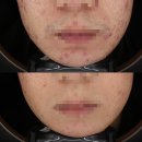 피어봄의원 이미지