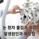 울산제일안과 이미지