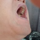 북삼치과의원 | 고령 하얀미소치과 후기 (20220225)