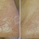 진성레이져 이미지