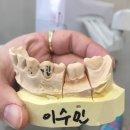 대윤치과 네이버블로그