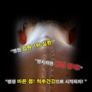 스마일신경외과 이미지