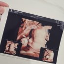 운정와이즈병원 | 운정 와이즈병원 임당검사 후기 + 26주 입체 초음파