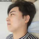 대전피부관리 전문 뷰티샵 추천 뷰티끄라윤 - 연예인라인샷 솔직후기