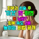 차앤박피부과의원 | 피부과 시술 후 '이것' 안 하면 돈 낭비? 회복 속도 2배 높이는 비법 공개