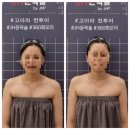 고아라컨투어샵 네이버블로그