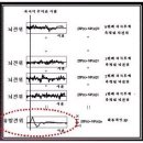 뇌파(EEG, Electroencephalogram) 개요 이미지