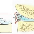 울산 박병원 - 무릎 통증, 반월판 연골 손상 이미지