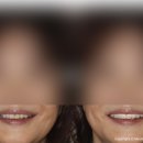 더스마일 치과기공소 이미지