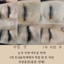 모란홍천