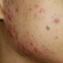 오창한의원 이미지