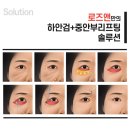 리프팅만으로도 인상개선 효과 최고! 분당얼굴리프팅 로즈앤성형외과