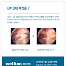 관절경수술잘하는곳 에서 말하는 전방십자인대파열 치료방법은? 이미지