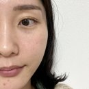 [울산] 달동 피부관리 문제성피부 전문맞춤케어 트로이필관리, 아르케스킨앤바디 울산점
