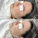 광장 메디칼 | 안산 고잔동 피부관리샵 메리미뷰티 리베룩관리 리얼 후기