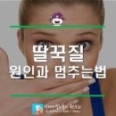 딸꾹질 계속 자주 나오는 원인은? 멈추는법 알기 이미지