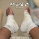 족저근막염 때문에 죽을뻔했네요.. 이미지