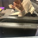 서울엘피부과의원 | 인천 구월동 내돈내산 비립종 제거 셀프 실패후 피부과 레이저 후기