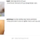 제이아이메디컬 이미지