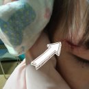 우리 아이 찢어진 상처, 골절, 화상시 기억해야하는 전문 병원