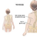 고려정형외과 네이버블로그
