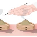 왕한의원 이미지