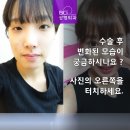 비씨아이성형외과의원 이미지