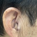 365보청기 이미지