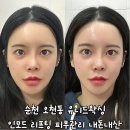유니드왁싱 | 순천 오천동 유니드왁싱 인모드 리프딩 피부관리 내돈내산