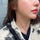 동일한의원 | 서면 안면비대칭교정 한의원 어느덧 5회차! 꽤 변화된 후기